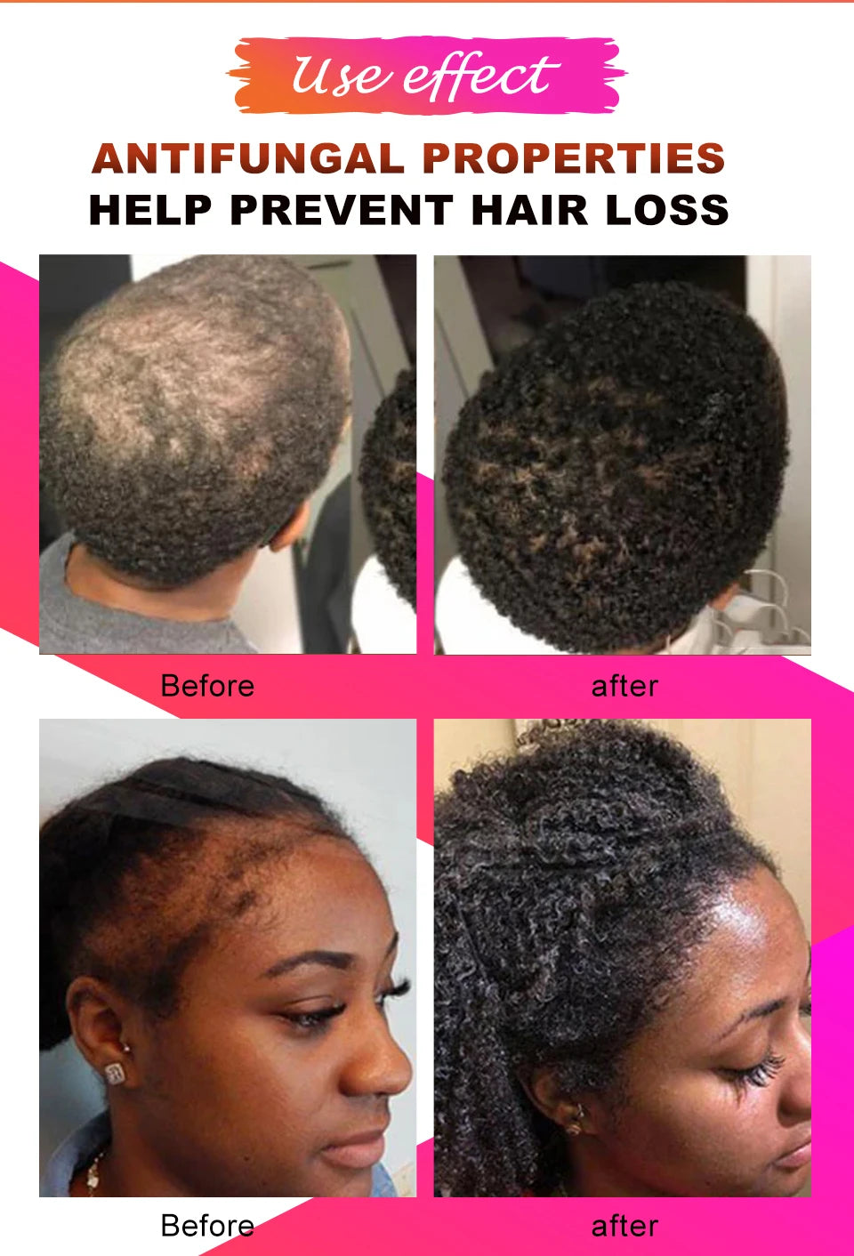 10ml African Chebe Spray Oil for Fast Hair Growth Repair Damaged Visible Result Stop Breakage Promotes Hair Growth For Women Men