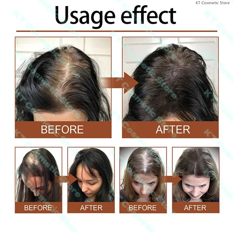 100ML Fast Hair Growth Oil Africa Crazy Traction Alopecia Serum Anti Hair Break Thicken Hair Loss Treatment Spray For Man Women