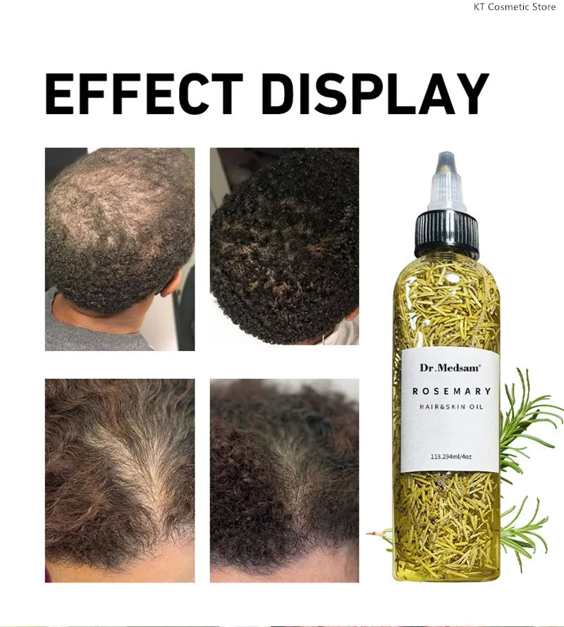 100ML Fast Hair Growth Oil Africa Crazy Traction Alopecia Serum Anti Hair Break Thicken Hair Loss Treatment Spray For Man Women