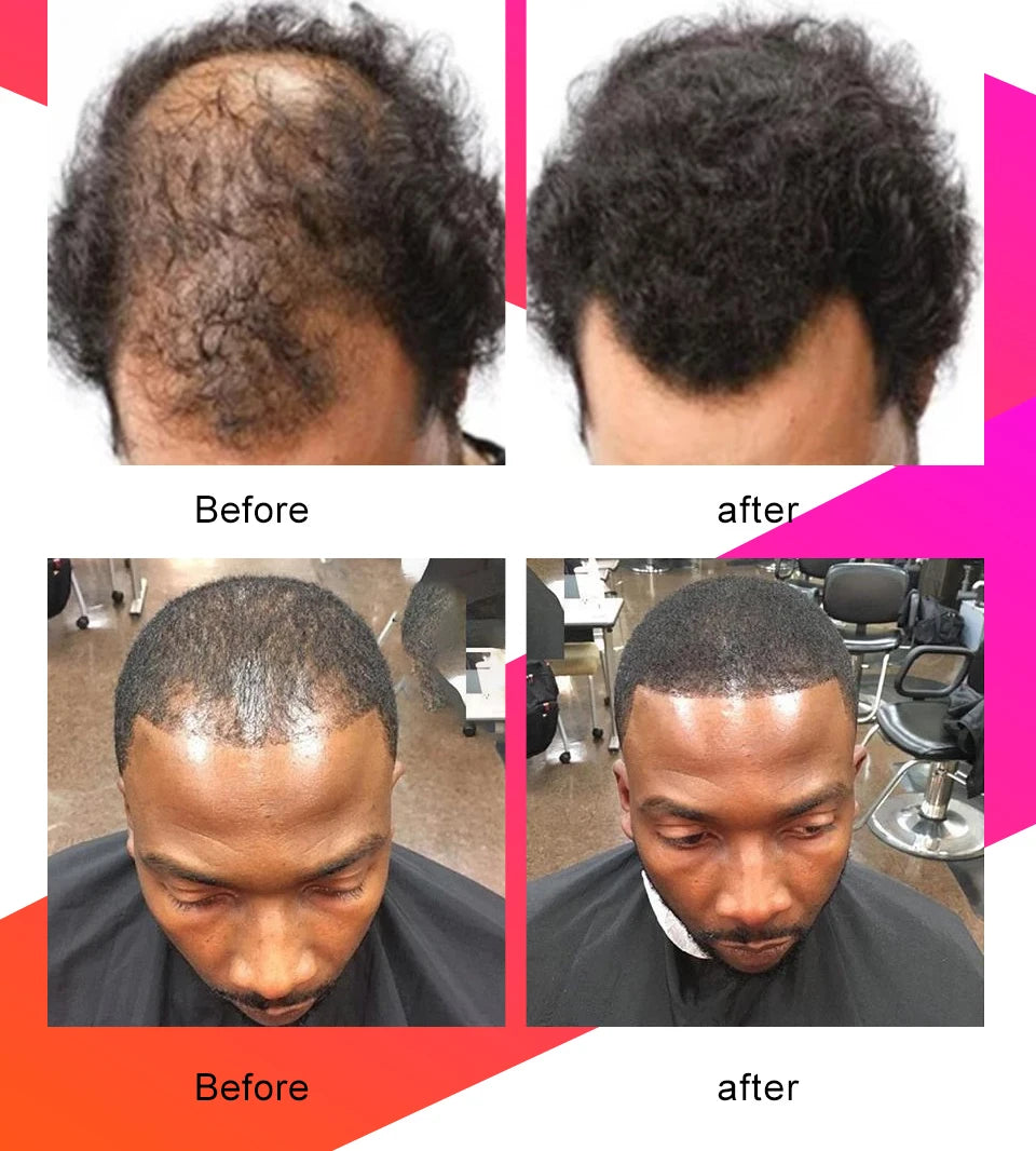 10ml African Chebe Spray Oil for Fast Hair Growth Repair Damaged Visible Result Stop Breakage Promotes Hair Growth For Women Men