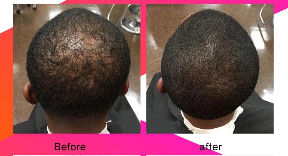 10ml African Chebe Spray Oil for Fast Hair Growth Repair Damaged Visible Result Stop Breakage Promotes Hair Growth For Women Men
