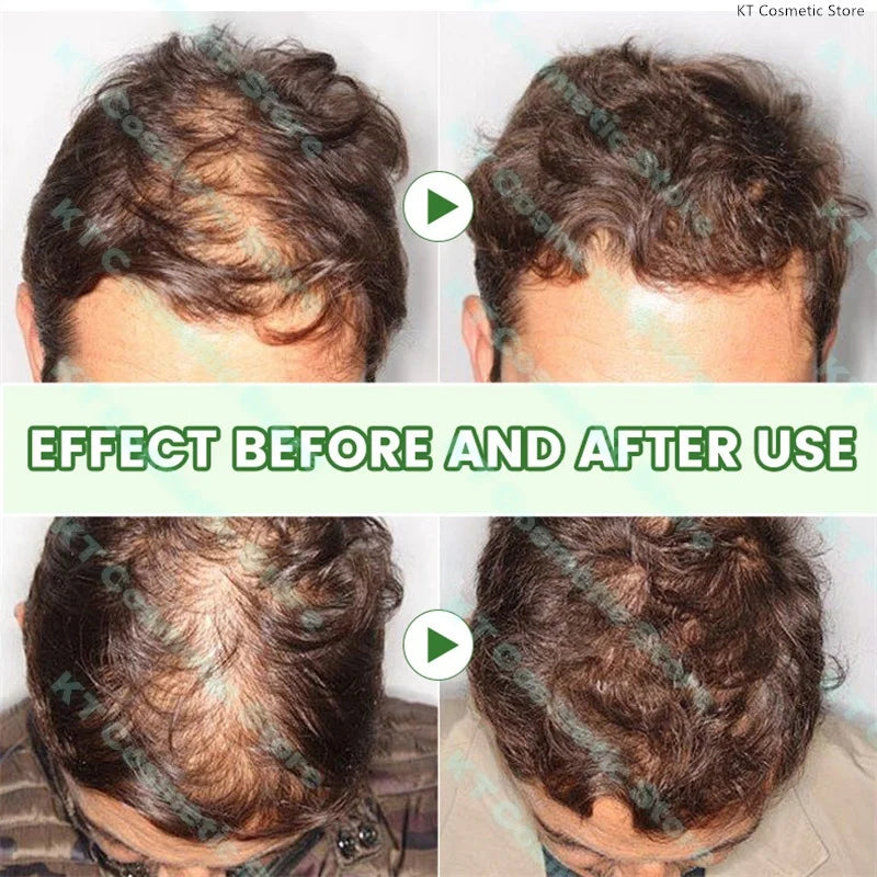 100ML Fast Hair Growth Oil Africa Crazy Traction Alopecia Serum Anti Hair Break Thicken Hair Loss Treatment Spray For Man Women
