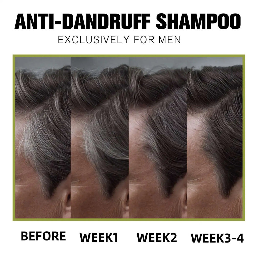 Anti Dandruff Shampoo Deep Clean Nourish Hair Roots Darken Hair Strengthen Hair 118ml Moisturizing Scalp Care Shampoo