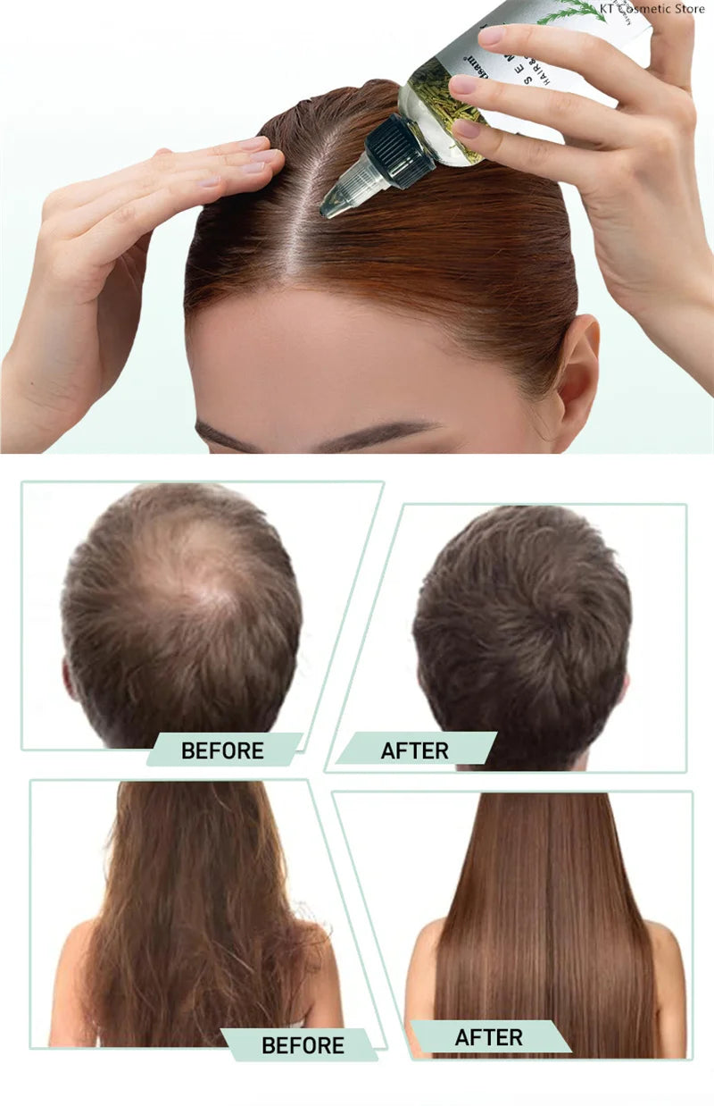 100ML Fast Hair Growth Oil Africa Crazy Traction Alopecia Serum Anti Hair Break Thicken Hair Loss Treatment Spray For Man Women