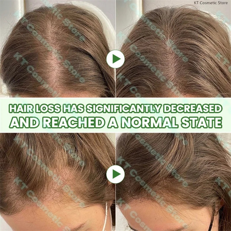 100ML Fast Hair Growth Oil Africa Crazy Traction Alopecia Serum Anti Hair Break Thicken Hair Loss Treatment Spray For Man Women