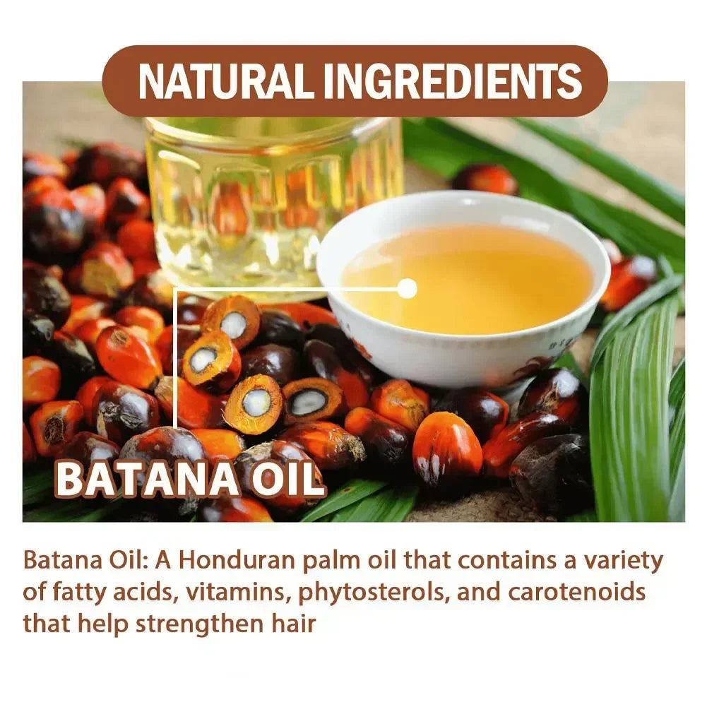 Batana Oil Hair Growth for Men Women Fast Growing Products Essential Oils Ginger Anti Hair Loss Scalp Treatment Hair Care 120ml